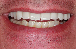 After Image: Smile