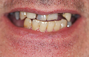 Before Image: Smile