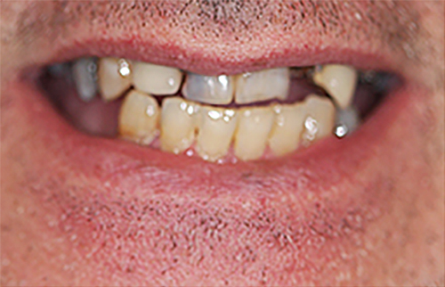 Before Image: Smile - front