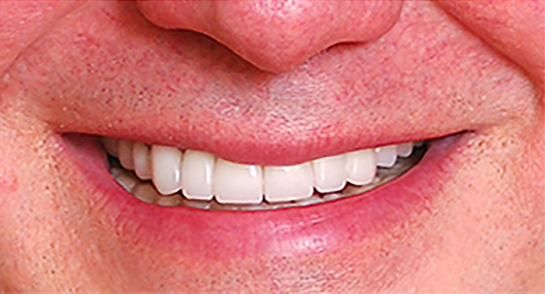 After Image: Smile - front