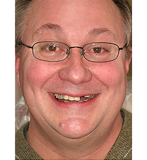Before Image: Smile - front