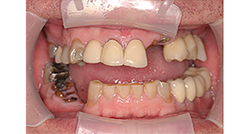 Before Image: Smile - front