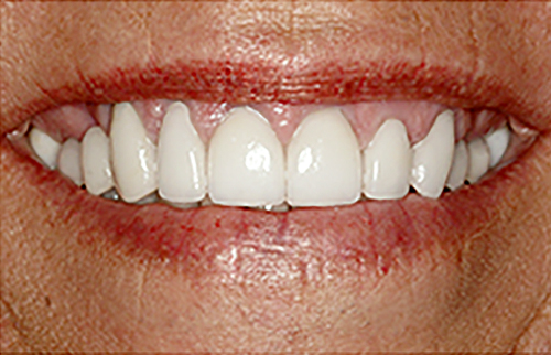 After Image: Smile - front