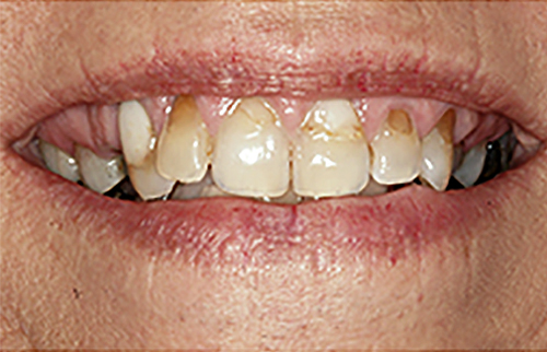 Before Image: Smile - front