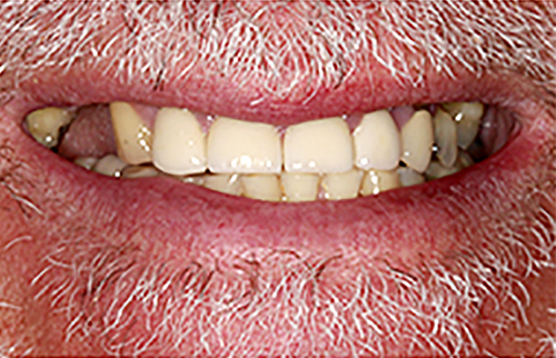 After Image: Smile - front