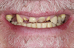 Before Image: Smile