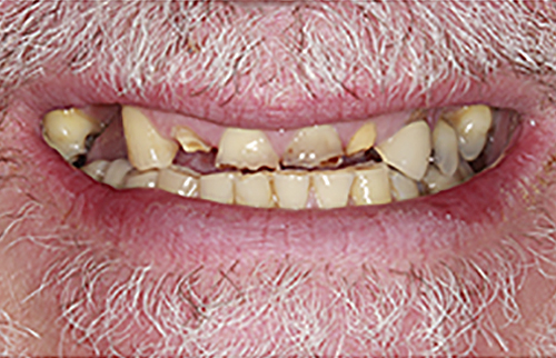 Before Image: Smile - front