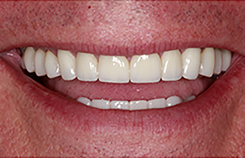 After Image: Smile - front