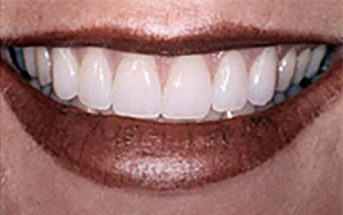 After Image: Smile - front