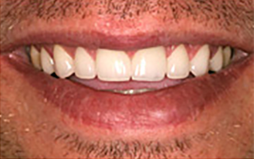 After Image: Smile - front