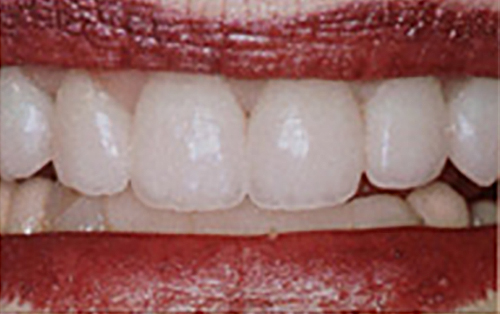 After Image: Smile - front