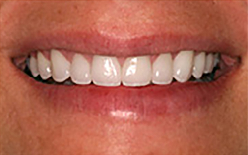 After Image: Smile - front