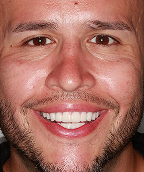 After Image: Smile - front